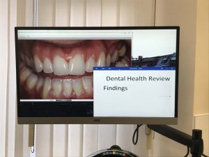 wigginton-dental-results-screen